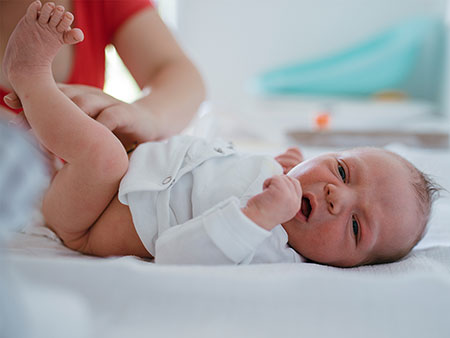 caring infant circumcision 24 1 - روش های مراقبت بعد از ختنه نوزاد