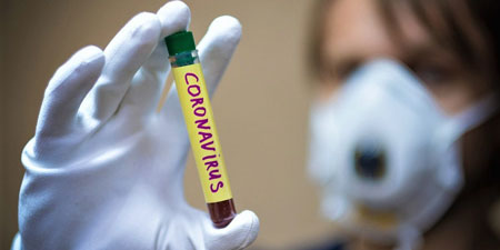 symptoms coronavirus1 9 1 - آشنایی با علائم ویروس کرونا