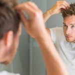 کاشت مو با بانک موی دیگران ممکن است؟ کاشت مو با بانک موی دیگران ممکن است؟