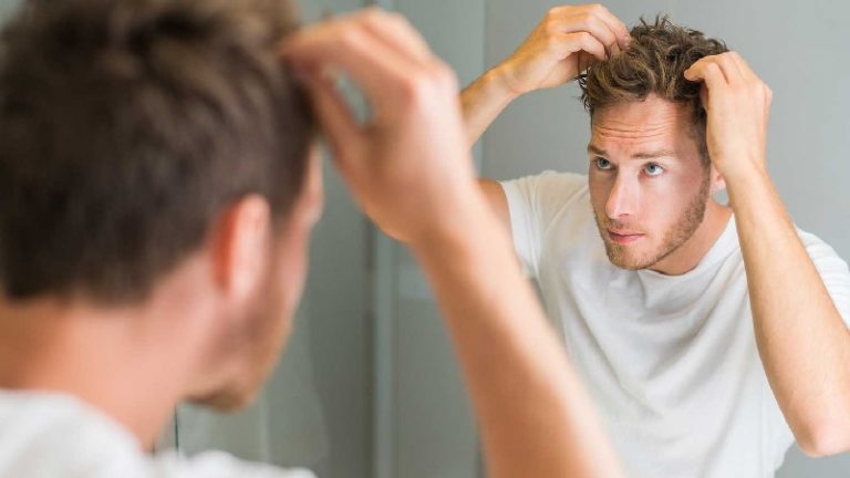 کاشت مو با بانک موی دیگران ممکن است؟