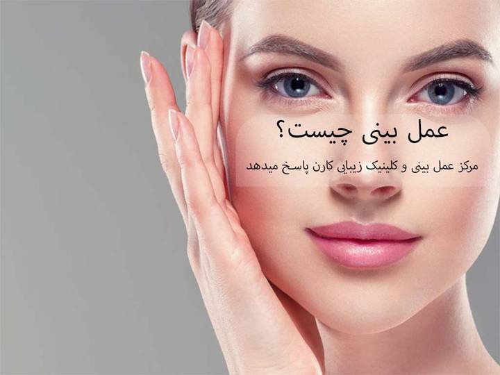 عمل بینی چیست؟ مرکز عمل بینی و کلینیک زیبایی کارن پاسخ میدهد عمل بینی چیست؟ مرکز عمل بینی و کلینیک زیبایی کارن پاسخ میدهد