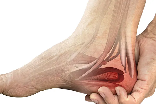 چگونه تشخیص دهیم که خار پاشنه یا تورم کف پا داریم؟