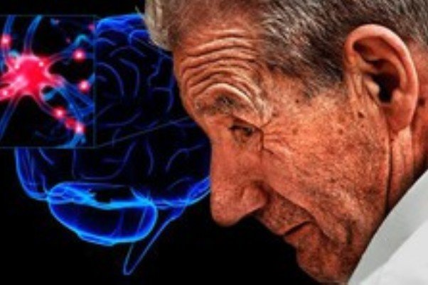 ارتباط ژنتیکی بین حجم مغز و اختلالات عصبی ارتباط ژنتیکی بین حجم مغز و اختلالات عصبی