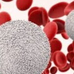 افت گلبول سفید خون، زنگ خطر سلامت بدن افت گلبول سفید خون، زنگ خطر سلامت بدن