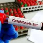 خبر خوش برای بیماران PKU؛ توزیع نان فاقد پروتئین